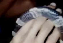 digigit ular weling