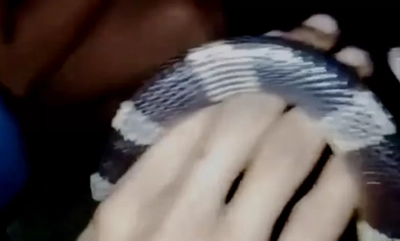 digigit ular weling